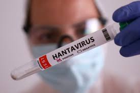 Hantavirus : comprendre un virus rare, mais à surveiller